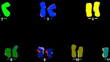 Human Chromosome Image